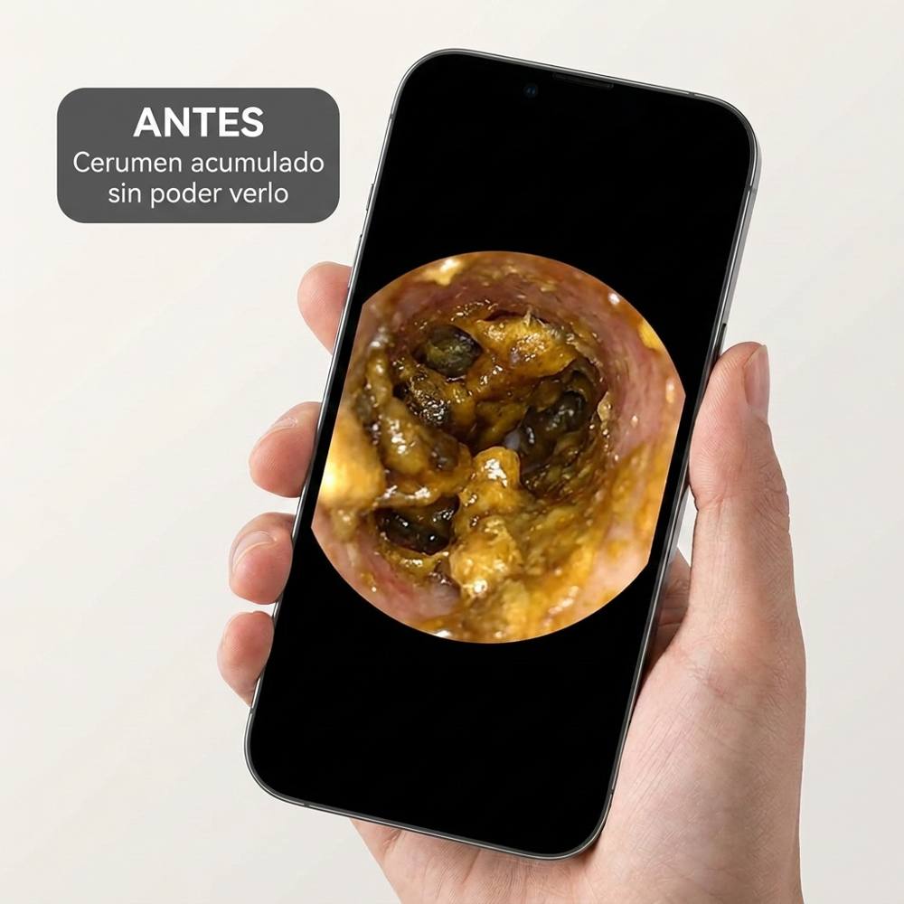 Antes: cerumen acumulado sin poder verlo